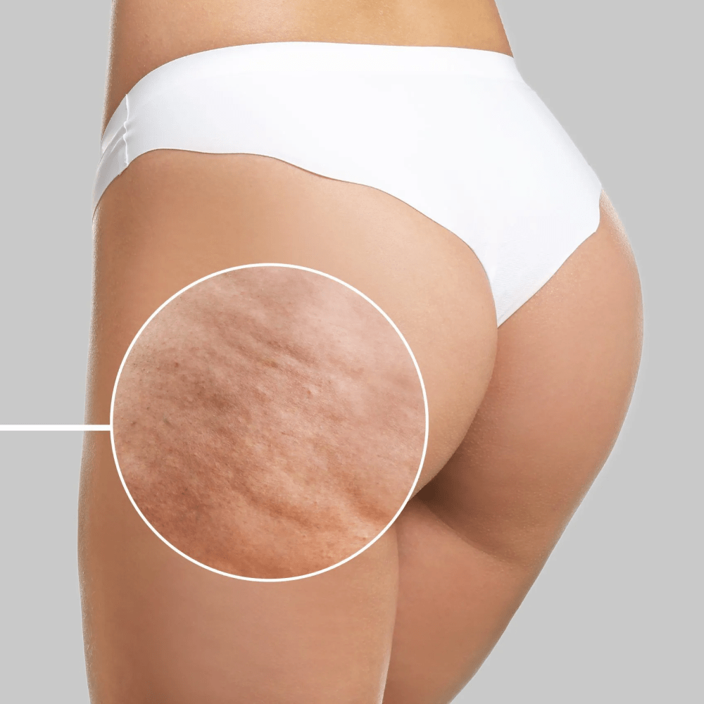 Treatment image