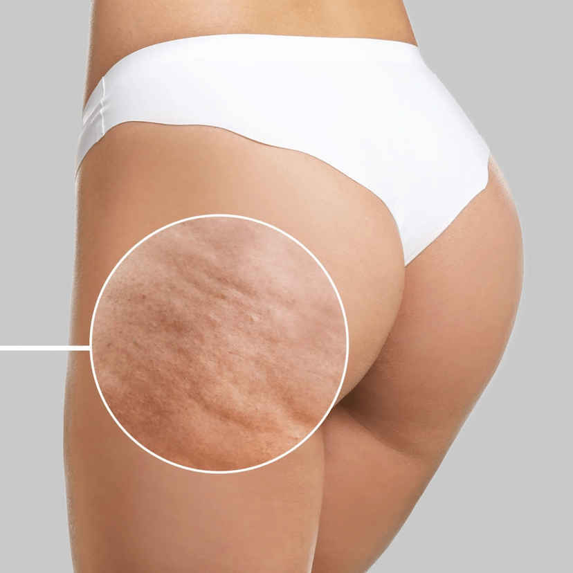 Treatment image