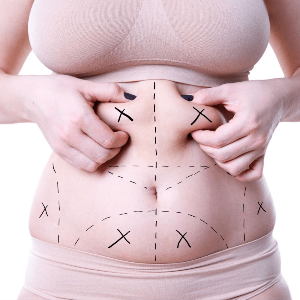Treatment image