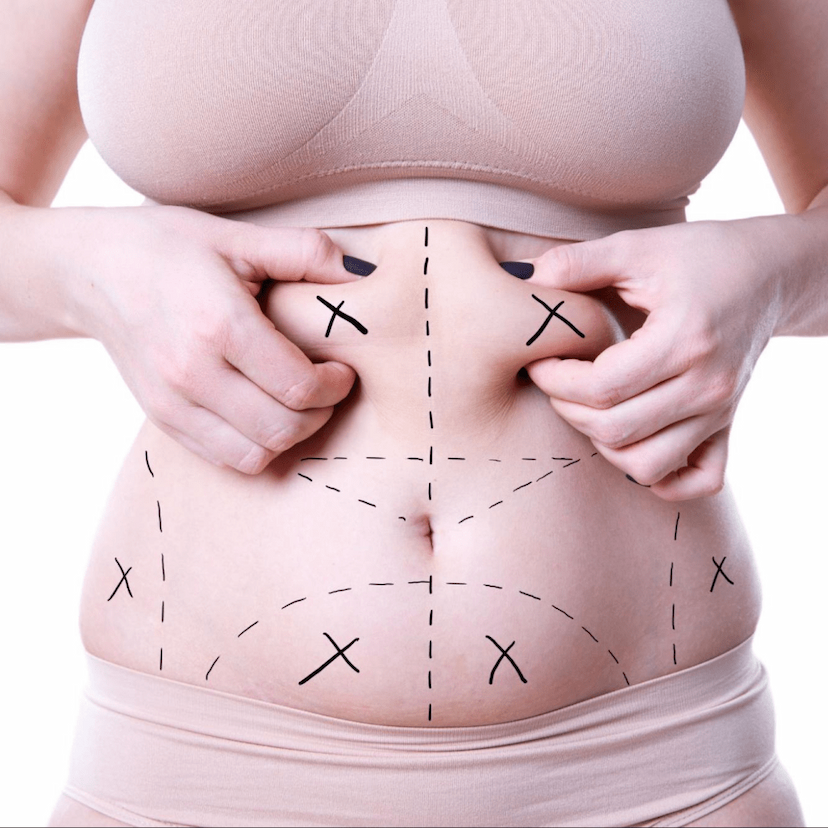Treatment image