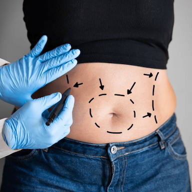 Treatment image