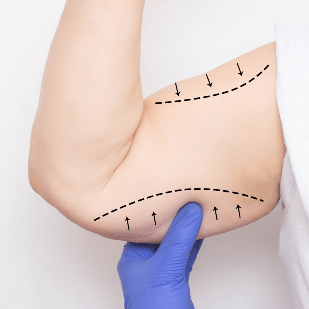 Treatment image